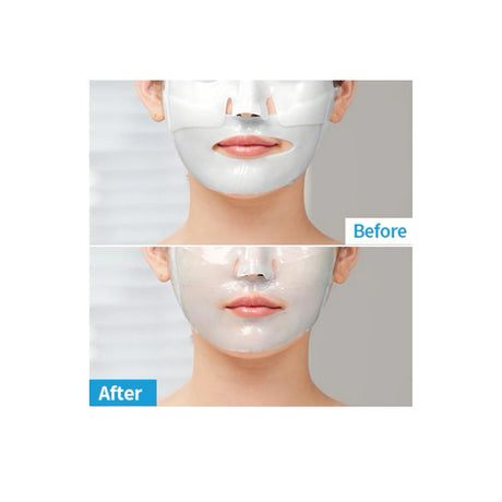MediAnswer Pore Collagen Mask naamio ennen ja jÀlkeen